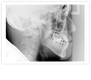 頭部X線規格撮影（セファログラム）の画像